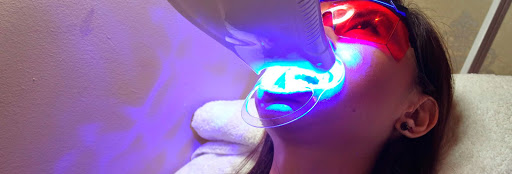 À Suresnes | Blanchiment dentaire | Les meilleures esthéticiennes