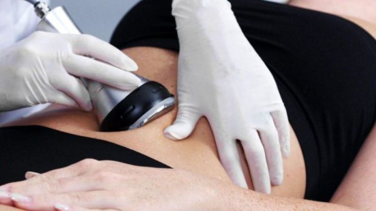 Lipocavitation / Radiofréquence / Drainage à Chevry-Cossigny (77) Par Wendy - Estheca