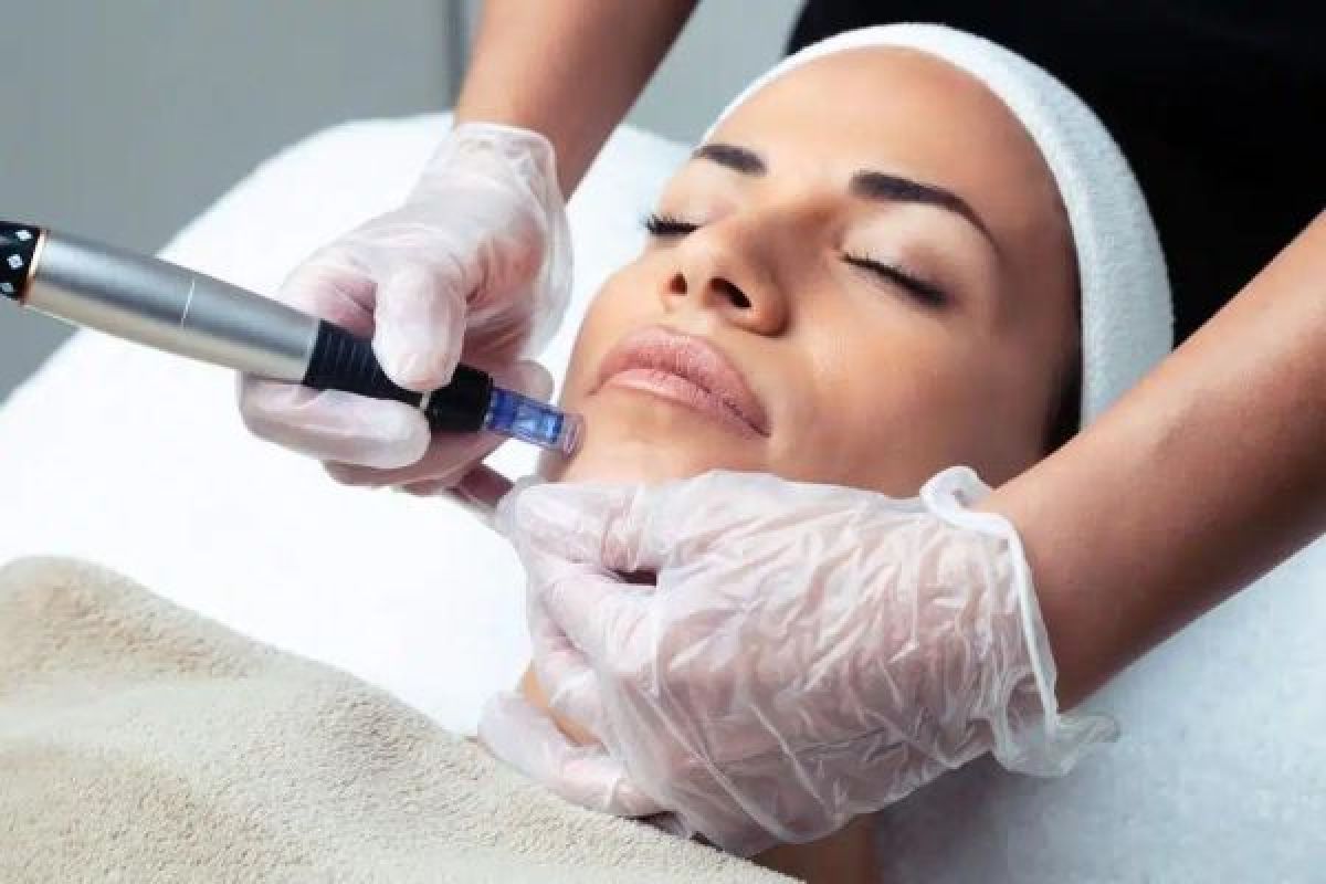 Microneedling  à Clichy-sous-Bois (93) Par Farah - Estheca