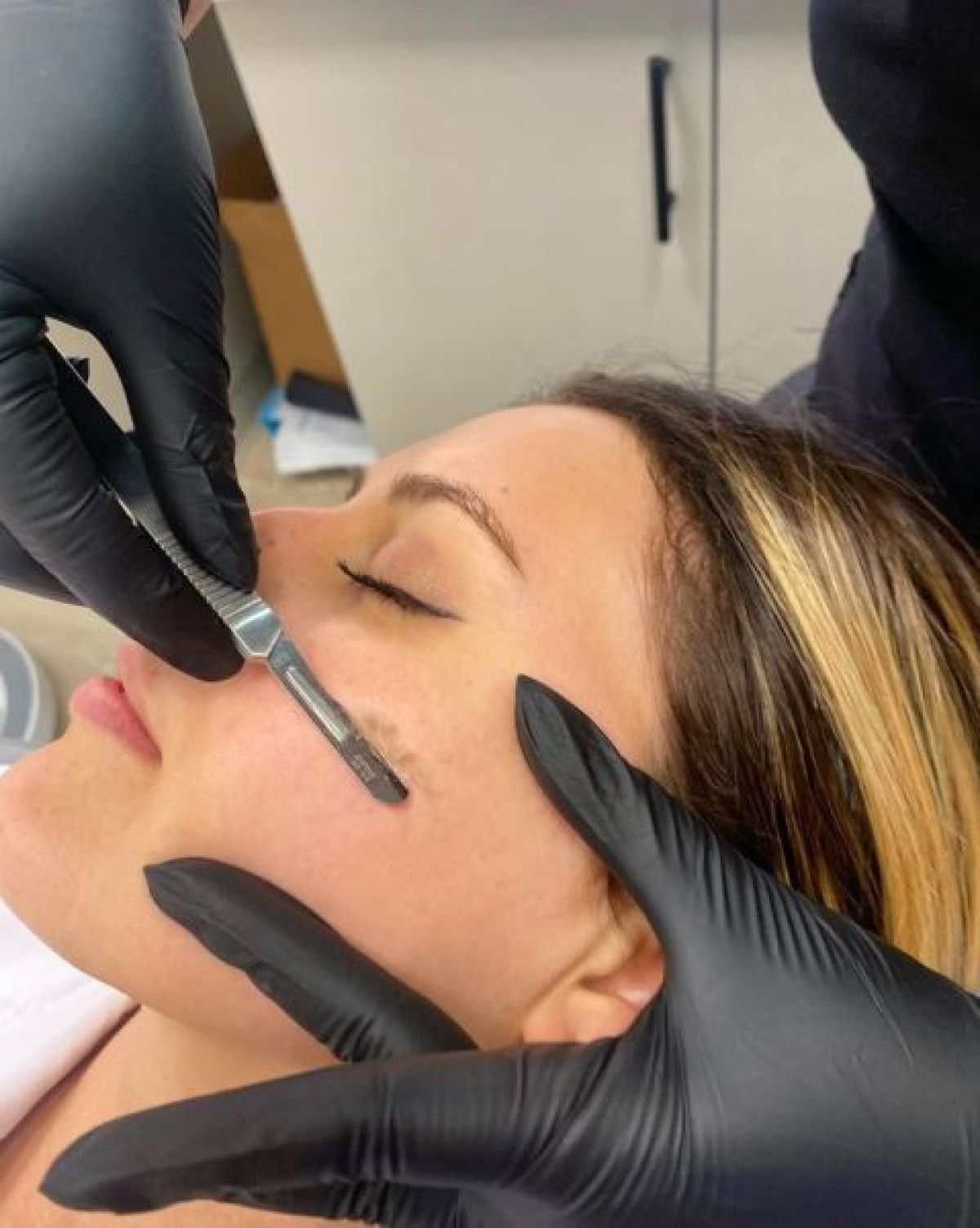 Dermaplaning à Paris (75) Par Fonseca - Estheca