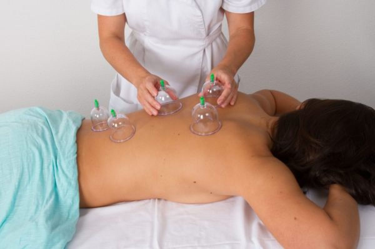 Cupping therapy (hijama) à Montreuil (93) Par Sarah - Estheca