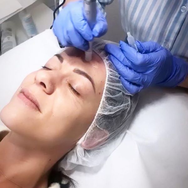 À Chevry-Cossigny | Microneedling BB GLOW | Les meilleures esthéticiennes