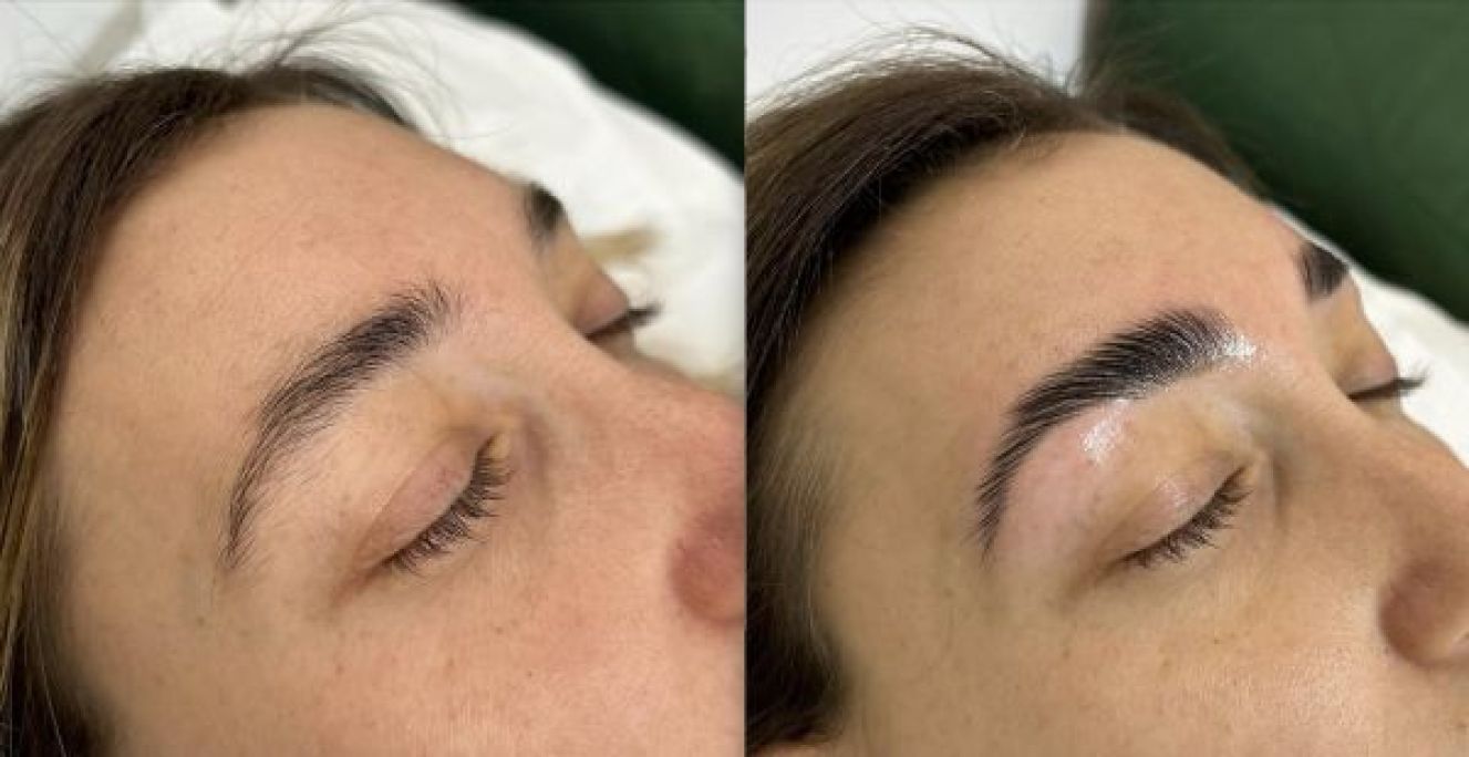 Browlift (rehaussement de sourcils) à Morières-lès-Avignon (84) Par Alexia - Estheca