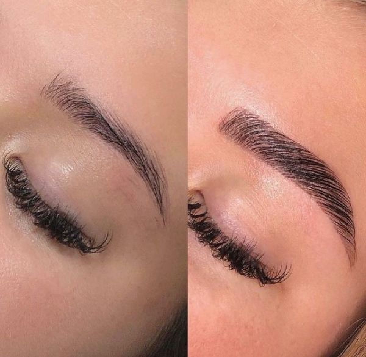 Browlift (rehaussement de sourcils) à Muret (31) Par Deborah - Estheca