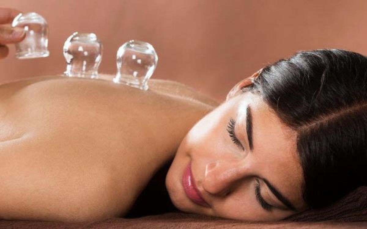 Cupping therapie à Courbevoie (92) Par Fatoumata - Estheca