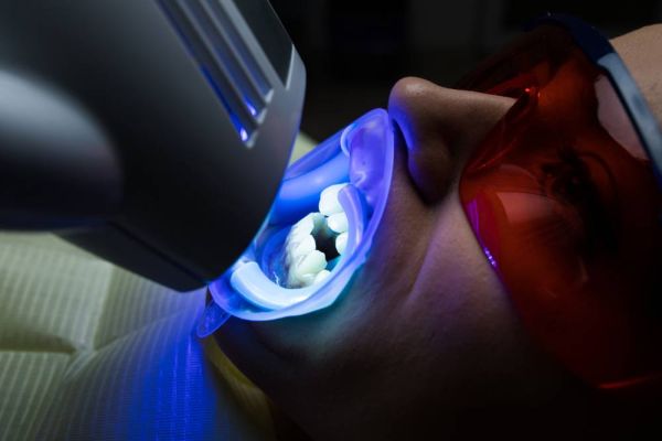 À Dordives | Blanchiment dentaire | Les meilleures esthéticiennes